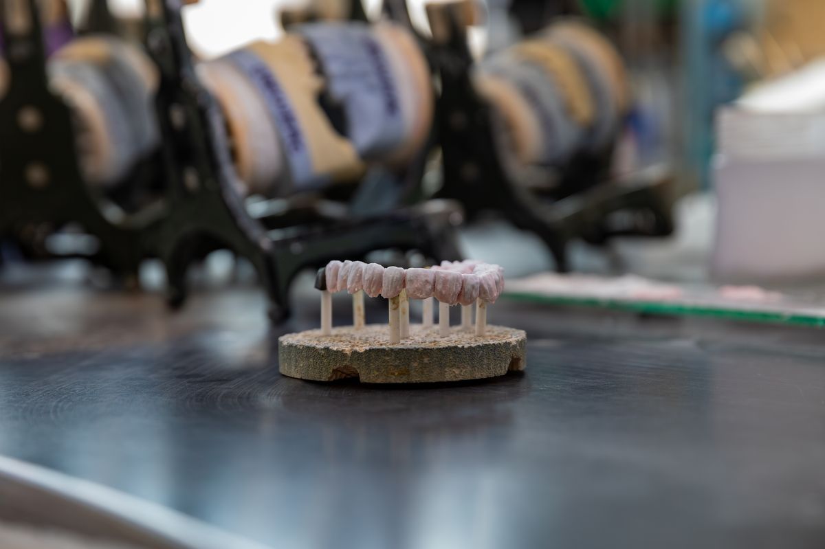 Lucrări pe implant — înșurubate — Pavăl Dent