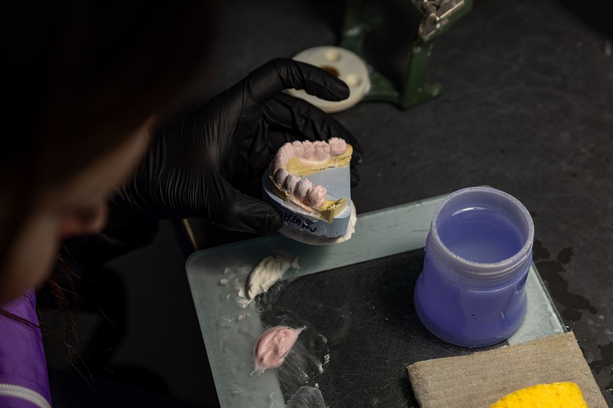 Fațetă ceramică presată — Pavăl Dent